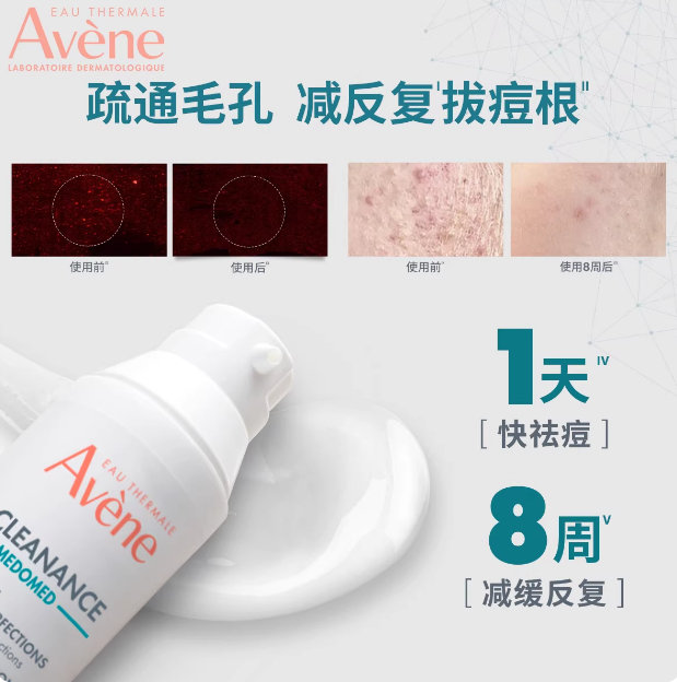 TB7.89雅漾.控油抗痘C位祛痘精华5ml*3支需要浏览商品时有掉落97折红包 - 夜晚笔记